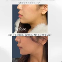 画像339