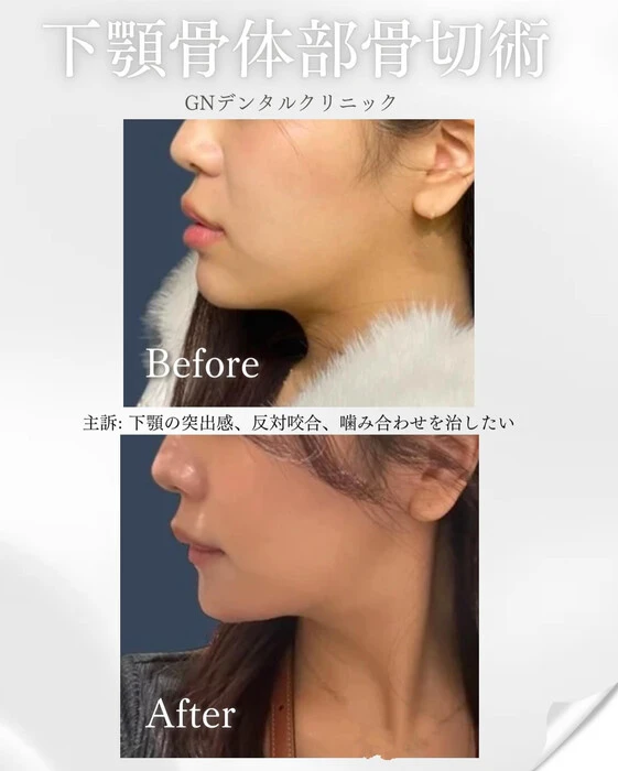 画像339