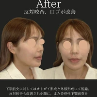 画像451