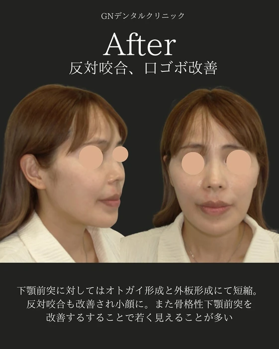 画像451